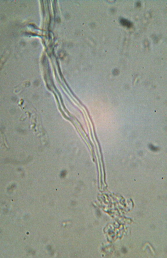 Steccherinum bourdotii